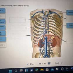 Correctly label the following arteries of the thorax