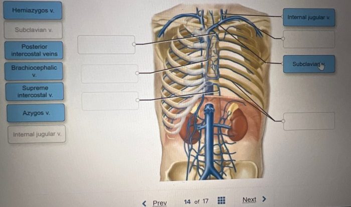 Correctly label the following arteries of the thorax