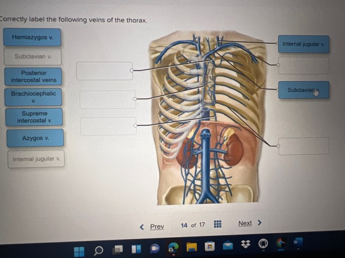 Correctly label the following arteries of the thorax