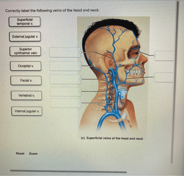 Correctly label the following arteries of the thorax