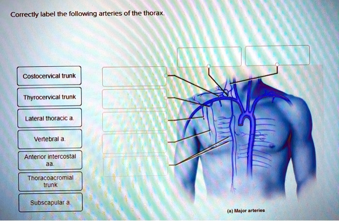 Correctly label the following arteries of the thorax